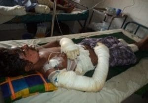 Injured worker due to gas cylinder explosion in Chittagong yard - 5 September